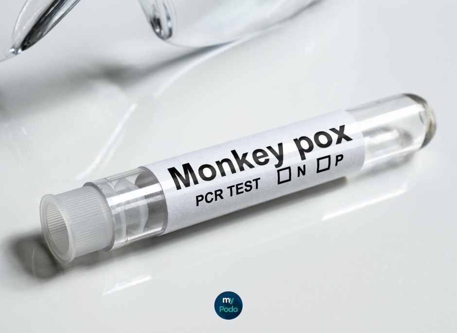 La variole du singe : un défi pour les pédicures-podologues et comment s’en protéger efficacement