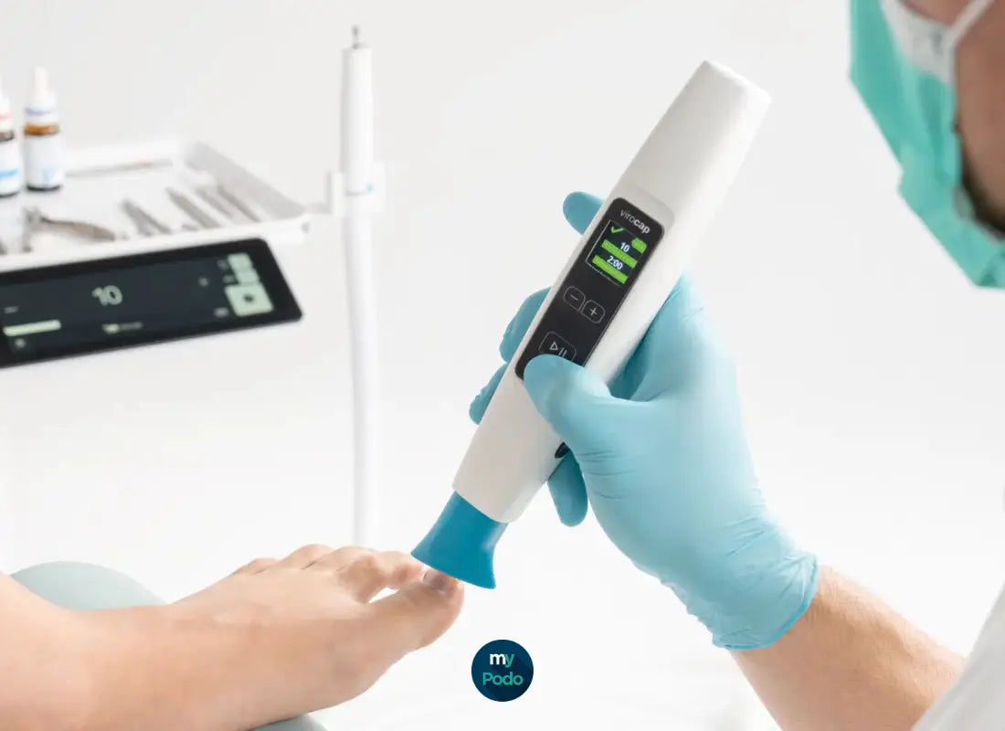 Protocole d'utilisation du ViroCap Ruck : traiter les mycoses au plasma froid My Podologie