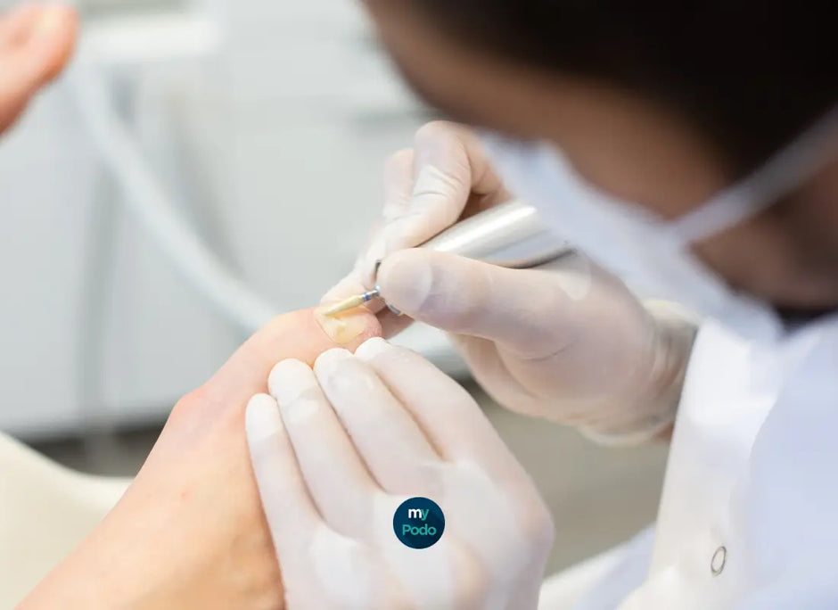 Technique de soin de pédicurie avec aspiration ou spray My Podologie