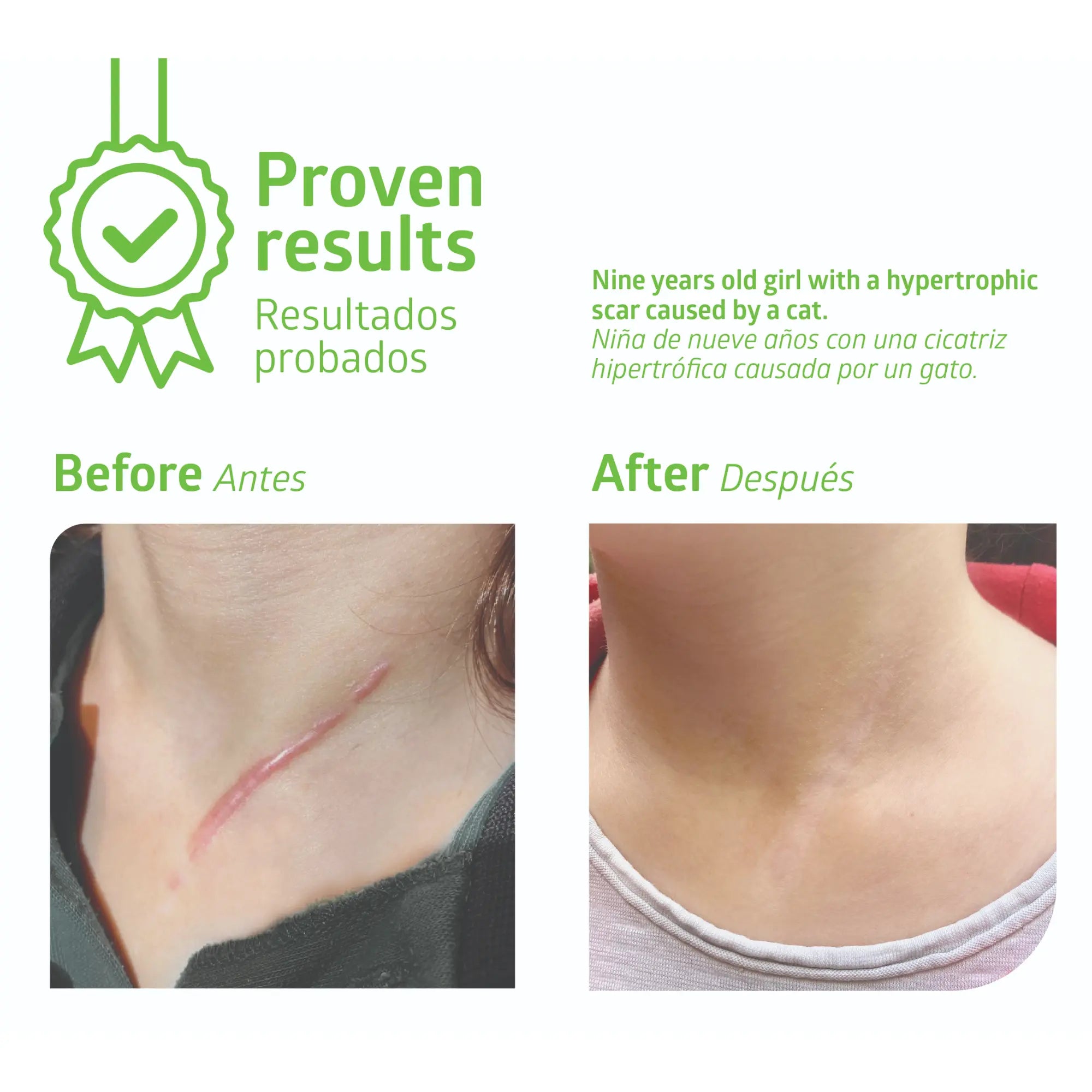 5 Feuilles de silicone fine - Épaisseur 0,4 mm - Plusieurs Dimensions - Fresco Fresco Podologia 