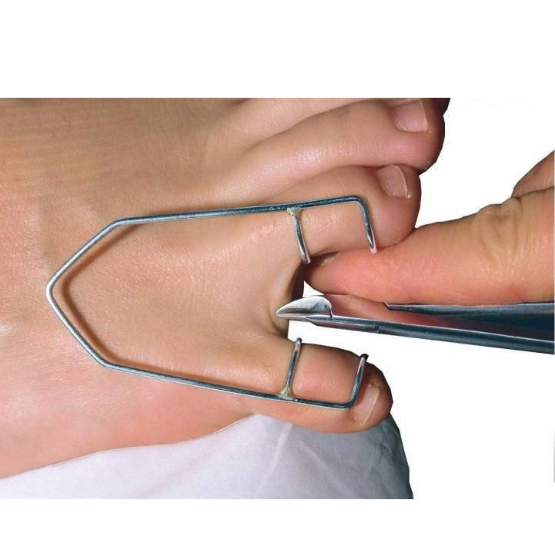 Divaricatore in acciaio inox - Ruck