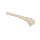 Tibia - Anatomia e patologia